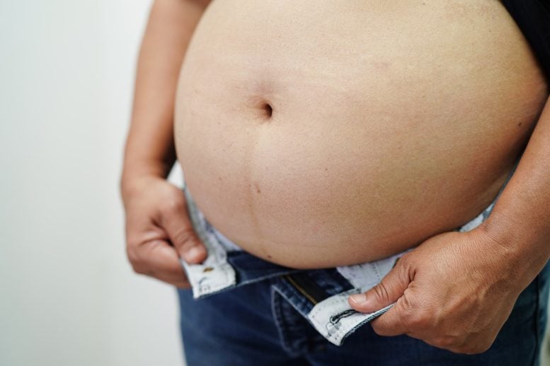 Fat Belly Woman Obesity