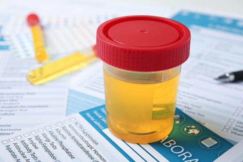 Urine Sample Tubes Laboratory Test