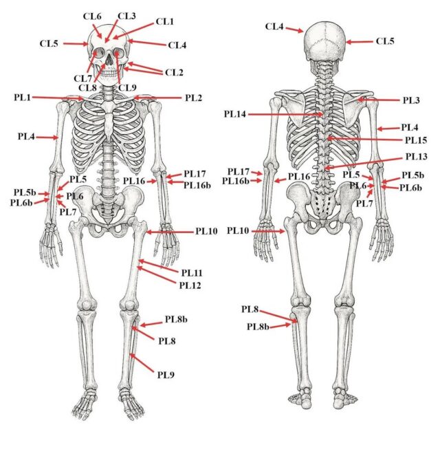 The observed perimortem lesions on the human remains (CL=cranial lesion, PL= Postcranial lesion). The drawing of the skeleton was generated using OpenAI’s image generation tools (DALL·E) via ChatGPT.